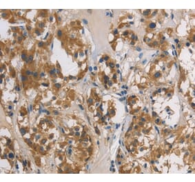 Immunohistochemistry - DUSP26 Antibody from Signalway Antibody (36427) - Antibodies.com