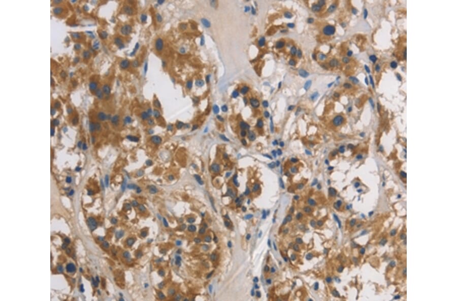 Immunohistochemistry - DUSP26 Antibody from Signalway Antibody (36427) - Antibodies.com