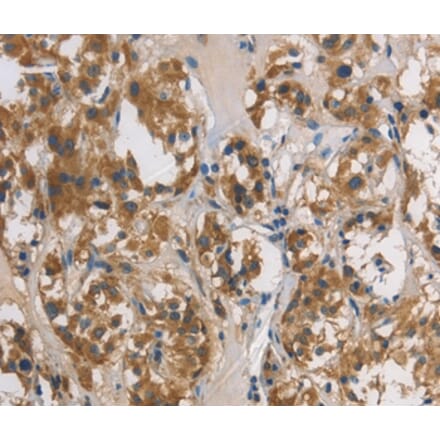 Immunohistochemistry - DUSP26 Antibody from Signalway Antibody (36427) - Antibodies.com