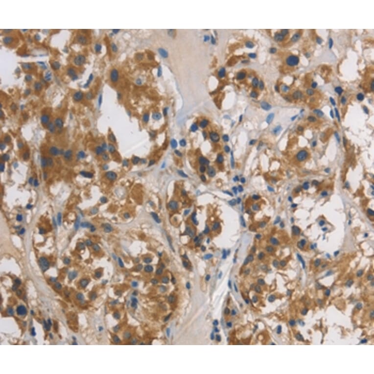 Immunohistochemistry - DUSP26 Antibody from Signalway Antibody (36427) - Antibodies.com