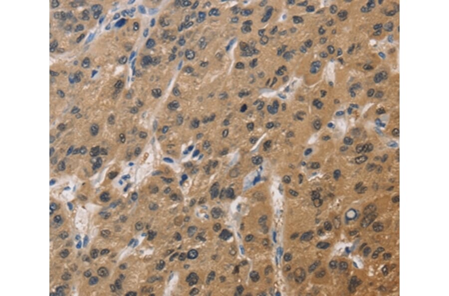 Immunohistochemistry - DUSP26 Antibody from Signalway Antibody (36427) - Antibodies.com