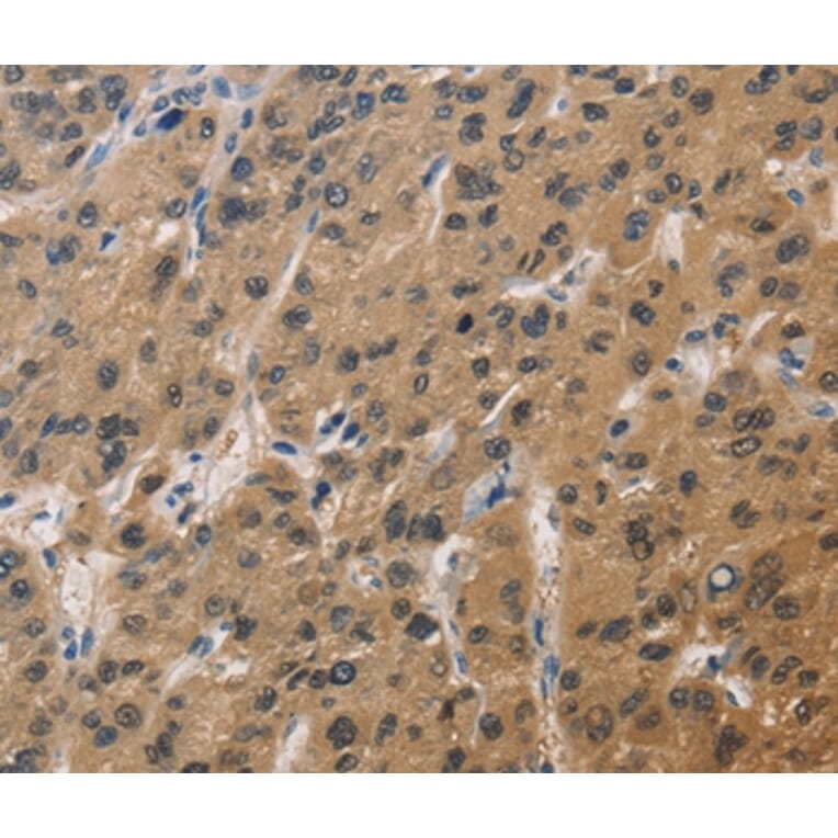 Immunohistochemistry - DUSP26 Antibody from Signalway Antibody (36427) - Antibodies.com