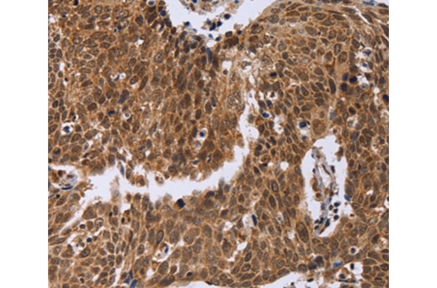 Immunohistochemistry - ERCC6L Antibody from Signalway Antibody (36448) - Antibodies.com