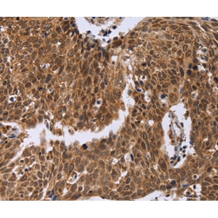 Immunohistochemistry - ERCC6L Antibody from Signalway Antibody (36448) - Antibodies.com