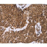 Immunohistochemistry - ERCC6L Antibody from Signalway Antibody (36448) - Antibodies.com