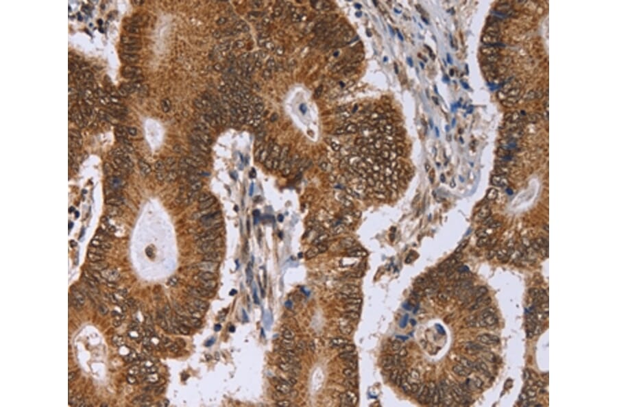 Immunohistochemistry - ERCC6L Antibody from Signalway Antibody (36448) - Antibodies.com
