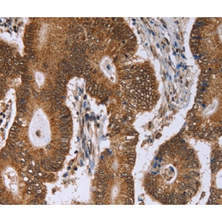 Immunohistochemistry - ERCC6L Antibody from Signalway Antibody (36448) - Antibodies.com