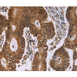 Immunohistochemistry - ERCC6L Antibody from Signalway Antibody (36448) - Antibodies.com
