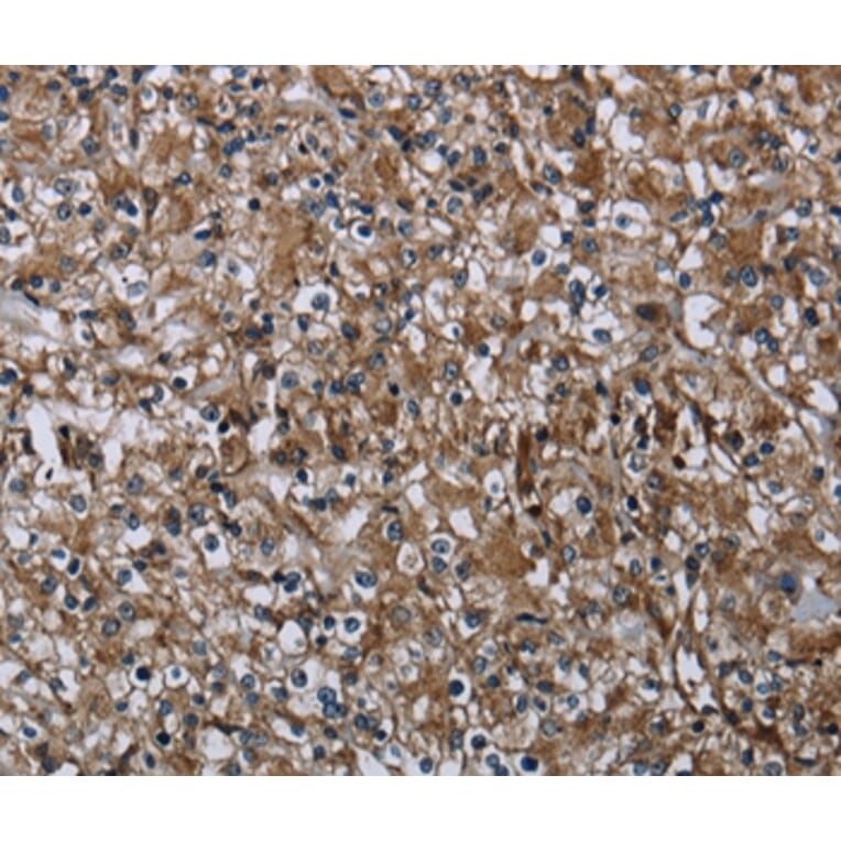 Immunohistochemistry - FAM89B Antibody from Signalway Antibody (36463) - Antibodies.com