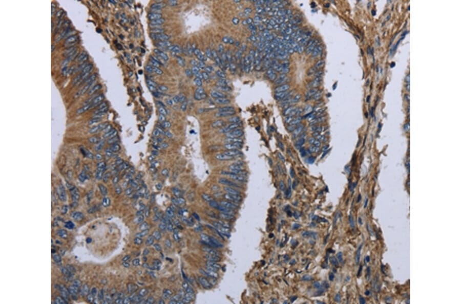 Immunohistochemistry - MCM3AP Antibody from Signalway Antibody (36495) - Antibodies.com
