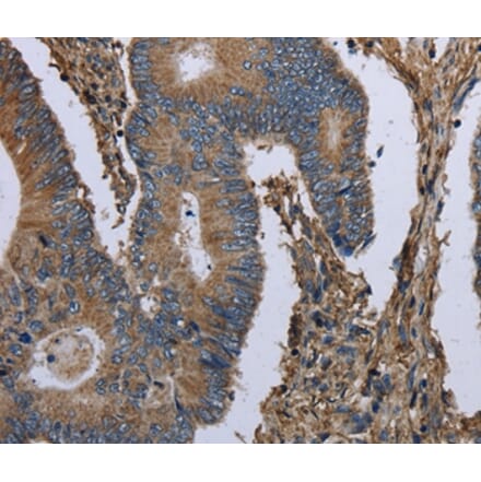 Immunohistochemistry - MCM3AP Antibody from Signalway Antibody (36495) - Antibodies.com