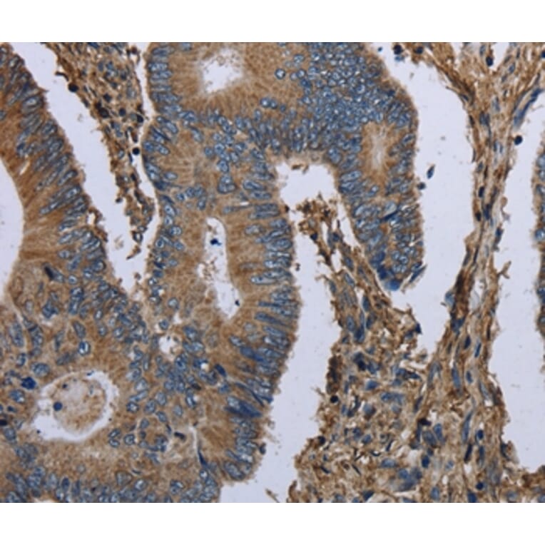 Immunohistochemistry - MCM3AP Antibody from Signalway Antibody (36495) - Antibodies.com