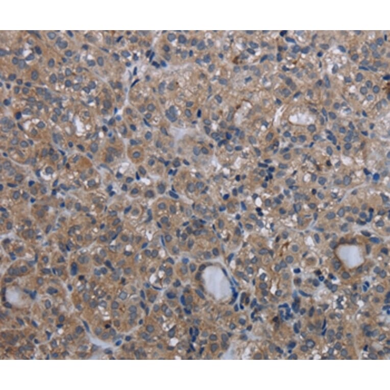 Immunohistochemistry - MCM3AP Antibody from Signalway Antibody (36495) - Antibodies.com