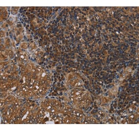 Immunohistochemistry - HOMER2 Antibody from Signalway Antibody (36524) - Antibodies.com