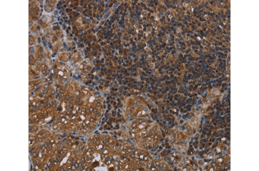 Immunohistochemistry - HOMER2 Antibody from Signalway Antibody (36524) - Antibodies.com