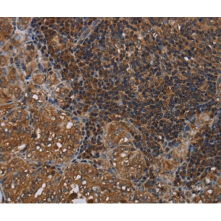 Immunohistochemistry - HOMER2 Antibody from Signalway Antibody (36524) - Antibodies.com