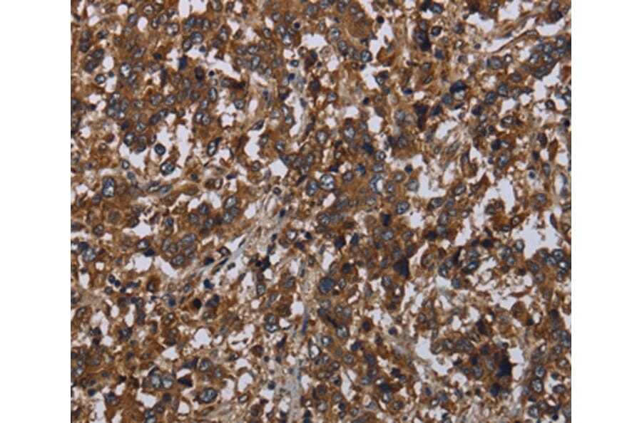 Immunohistochemistry - HOMER2 Antibody from Signalway Antibody (36524) - Antibodies.com