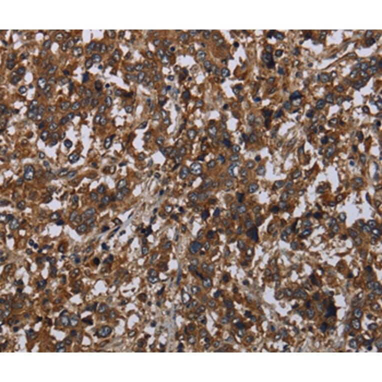 Immunohistochemistry - HOMER2 Antibody from Signalway Antibody (36524) - Antibodies.com