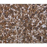 Immunohistochemistry - HOMER2 Antibody from Signalway Antibody (36524) - Antibodies.com