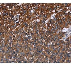 Immunohistochemistry - FCGR3A Antibody from Signalway Antibody (36548) - Antibodies.com