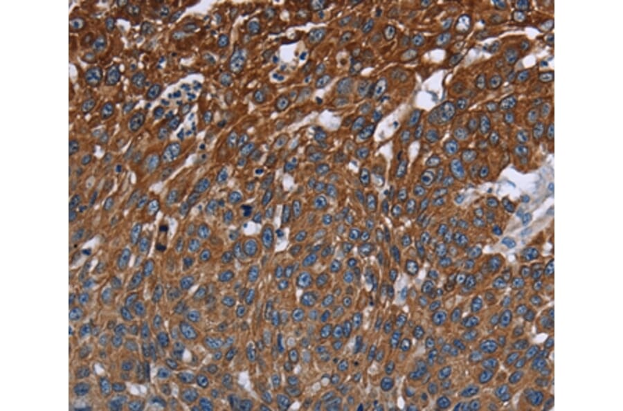 Immunohistochemistry - FCGR3A Antibody from Signalway Antibody (36548) - Antibodies.com