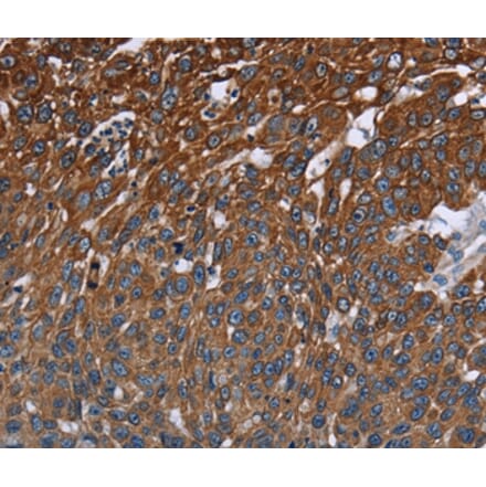 Immunohistochemistry - FCGR3A Antibody from Signalway Antibody (36548) - Antibodies.com