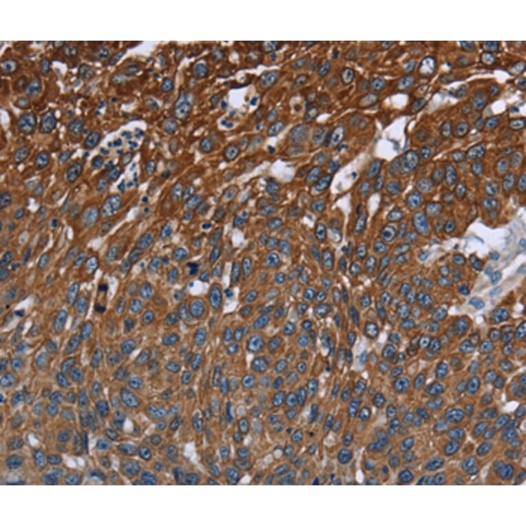 Immunohistochemistry - FCGR3A Antibody from Signalway Antibody (36548) - Antibodies.com