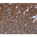 Immunohistochemistry - FCGR3A Antibody from Signalway Antibody (36548) - Antibodies.com