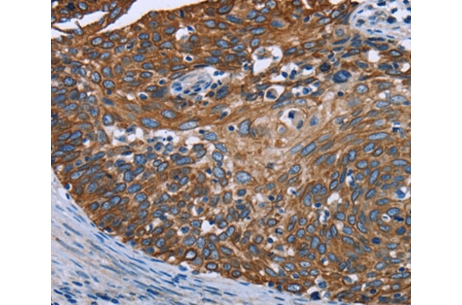 Immunohistochemistry - FCGR3A Antibody from Signalway Antibody (36548) - Antibodies.com