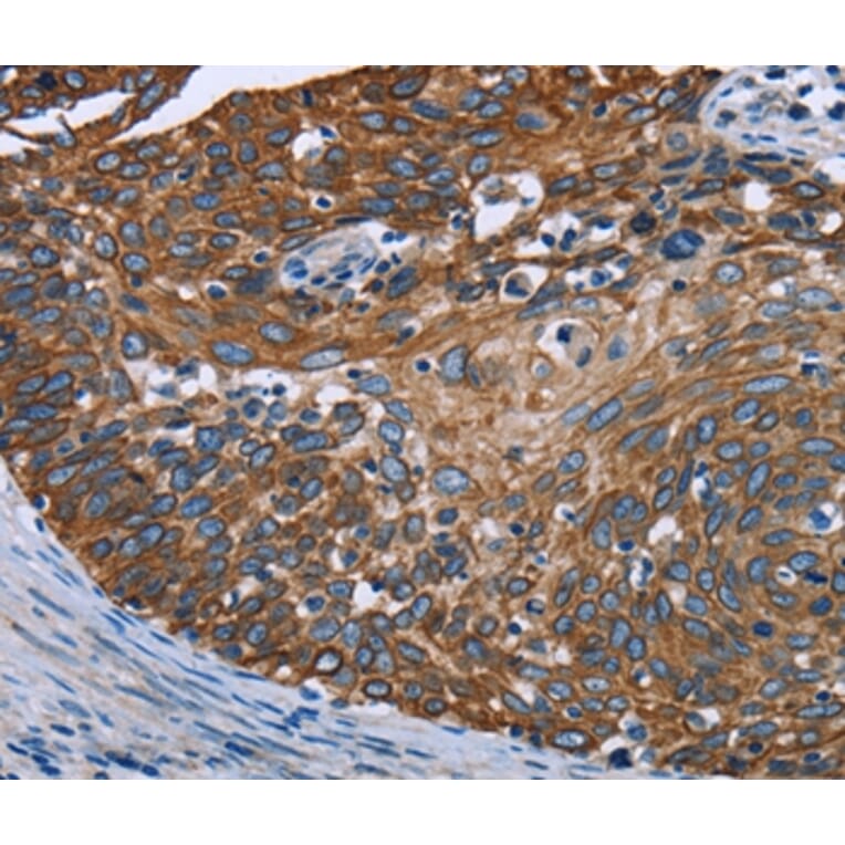 Immunohistochemistry - FCGR3A Antibody from Signalway Antibody (36548) - Antibodies.com