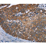 Immunohistochemistry - FCGR3A Antibody from Signalway Antibody (36548) - Antibodies.com