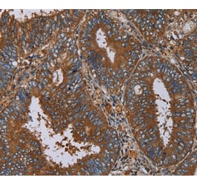 Immunohistochemistry - IL27RA Antibody from Signalway Antibody (36553) - Antibodies.com