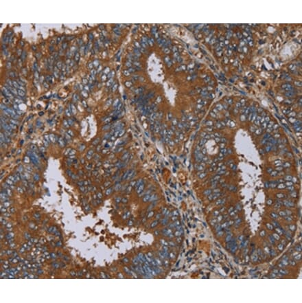 Immunohistochemistry - IL27RA Antibody from Signalway Antibody (36553) - Antibodies.com