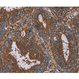 Immunohistochemistry - IL27RA Antibody from Signalway Antibody (36553) - Antibodies.com