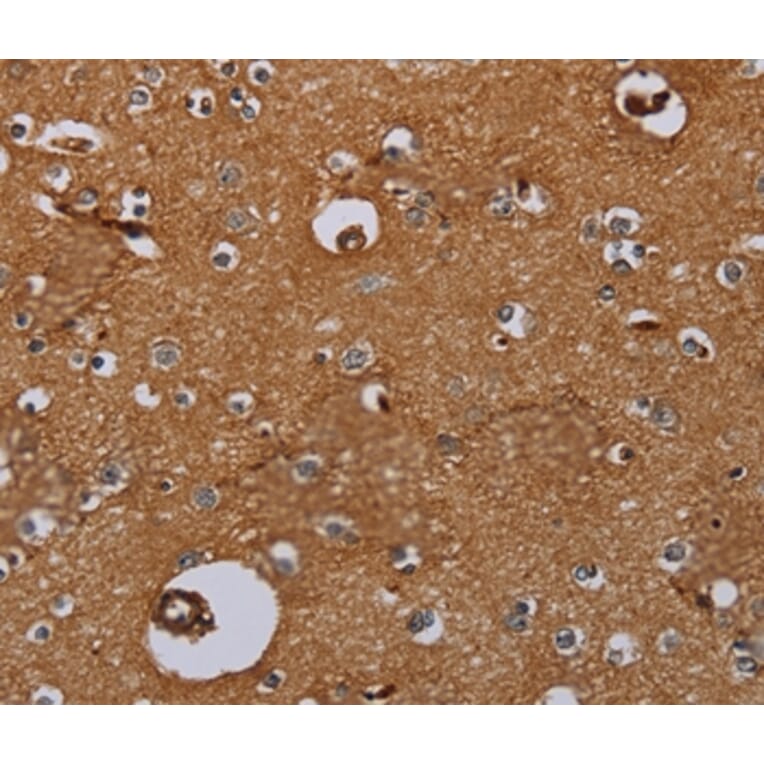 Immunohistochemistry - IL27RA Antibody from Signalway Antibody (36553) - Antibodies.com