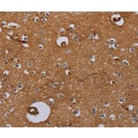 Immunohistochemistry - IL27RA Antibody from Signalway Antibody (36553) - Antibodies.com