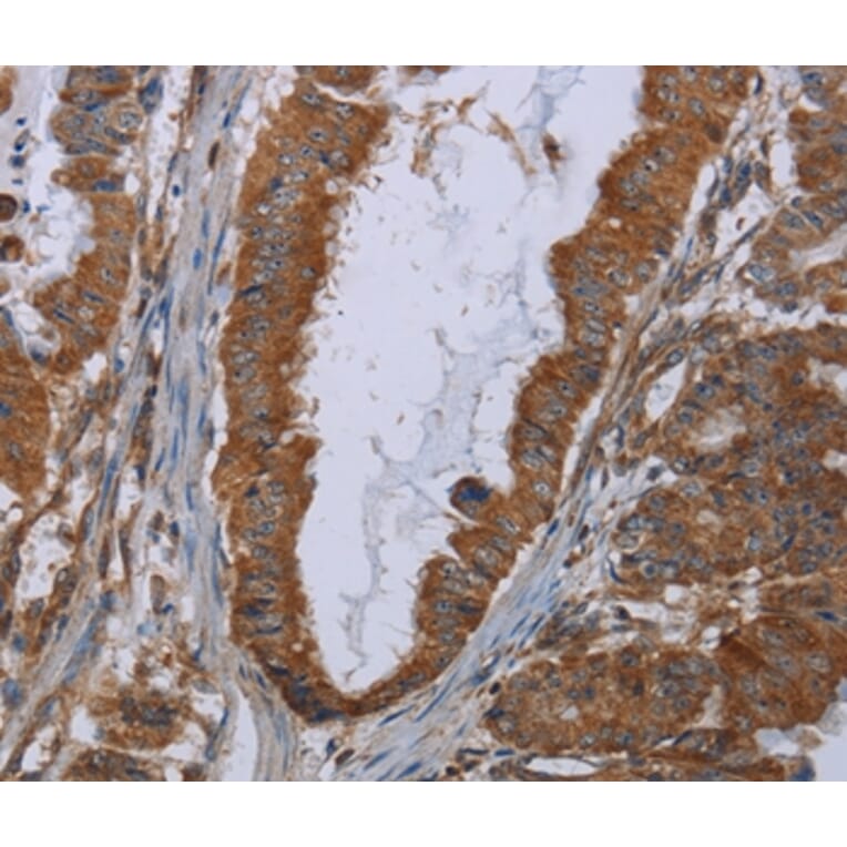 Immunohistochemistry - INSIG2 Antibody from Signalway Antibody (36556) - Antibodies.com