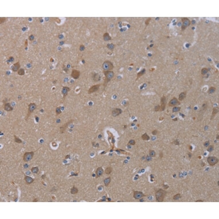 Immunohistochemistry - INSIG2 Antibody from Signalway Antibody (36556) - Antibodies.com