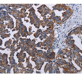 Immunohistochemistry - TRIM13 Antibody from Signalway Antibody (36585) - Antibodies.com