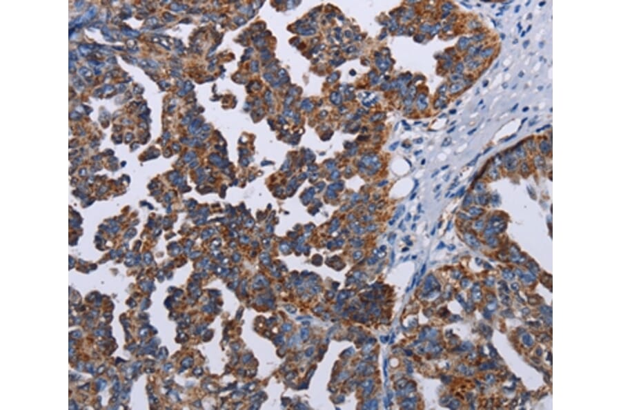 Immunohistochemistry - TRIM13 Antibody from Signalway Antibody (36585) - Antibodies.com