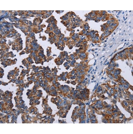 Immunohistochemistry - TRIM13 Antibody from Signalway Antibody (36585) - Antibodies.com