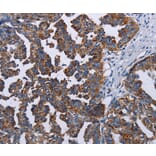 Immunohistochemistry - TRIM13 Antibody from Signalway Antibody (36585) - Antibodies.com