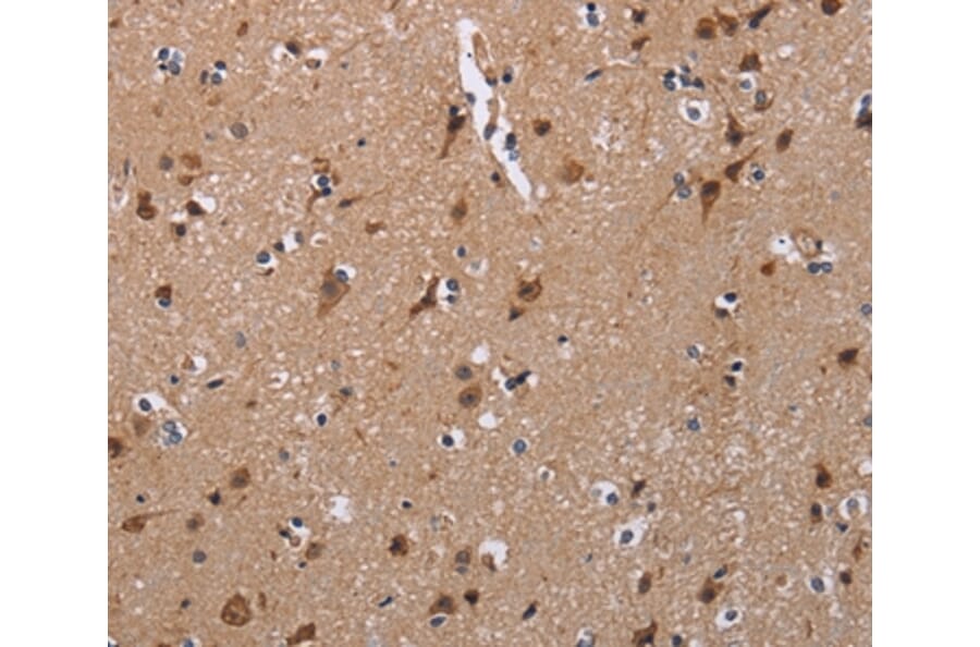 Immunohistochemistry - TRIM13 Antibody from Signalway Antibody (36585) - Antibodies.com