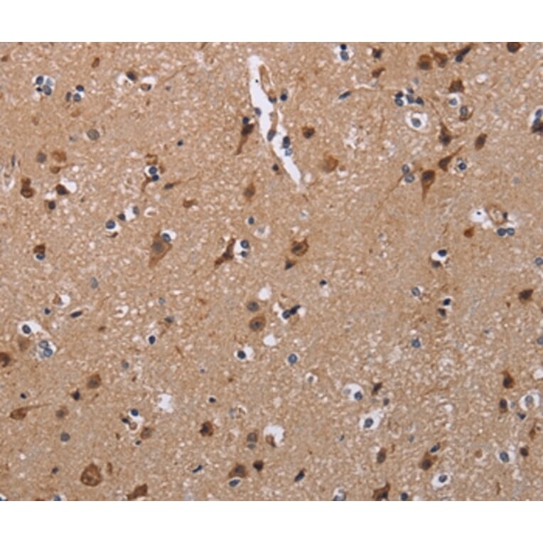 Immunohistochemistry - TRIM13 Antibody from Signalway Antibody (36585) - Antibodies.com
