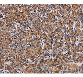 Immunohistochemistry - LRRC15 Antibody from Signalway Antibody (36589) - Antibodies.com