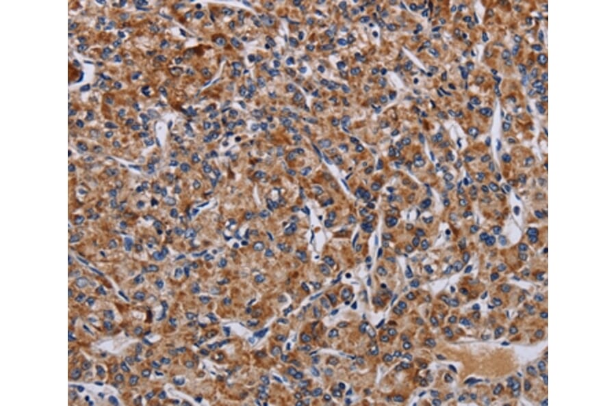 Immunohistochemistry - LRRC15 Antibody from Signalway Antibody (36589) - Antibodies.com