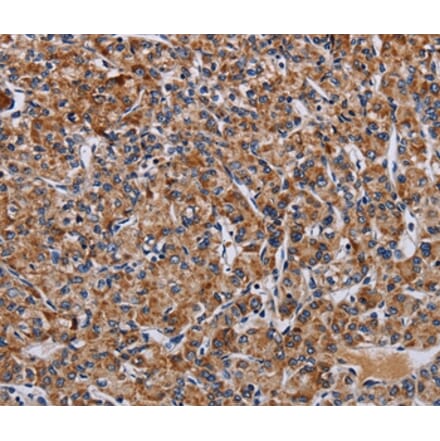 Immunohistochemistry - LRRC15 Antibody from Signalway Antibody (36589) - Antibodies.com