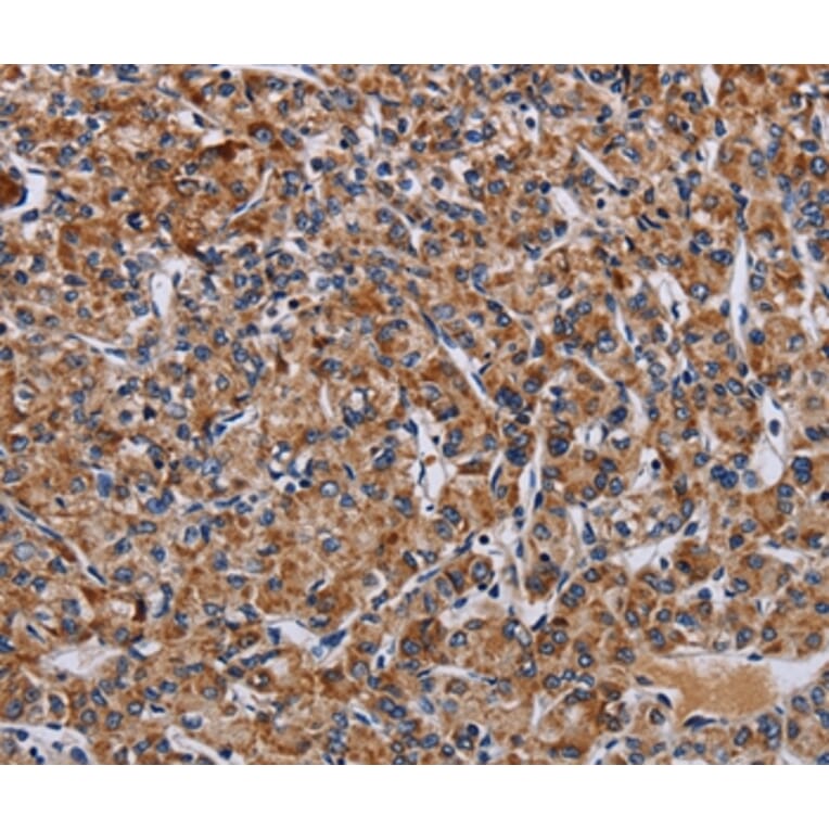 Immunohistochemistry - LRRC15 Antibody from Signalway Antibody (36589) - Antibodies.com