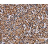 Immunohistochemistry - LRRC15 Antibody from Signalway Antibody (36589) - Antibodies.com