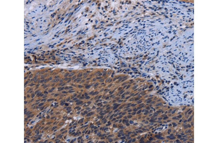 Immunohistochemistry - LRRC15 Antibody from Signalway Antibody (36589) - Antibodies.com